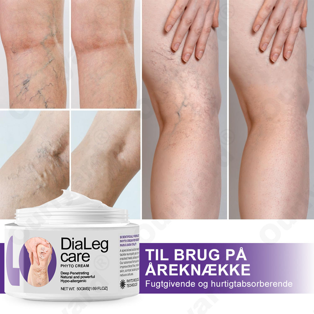 👨⚕️𝐎𝐮𝐫𝐥𝐲𝐚𝐫𝐝®𝐃𝐢𝐚𝐋𝐞𝐠 𝐜𝐚𝐫𝐞 𝐏𝐡𝐲𝐭𝐨 𝐜𝐫𝐞𝐦𝐞
