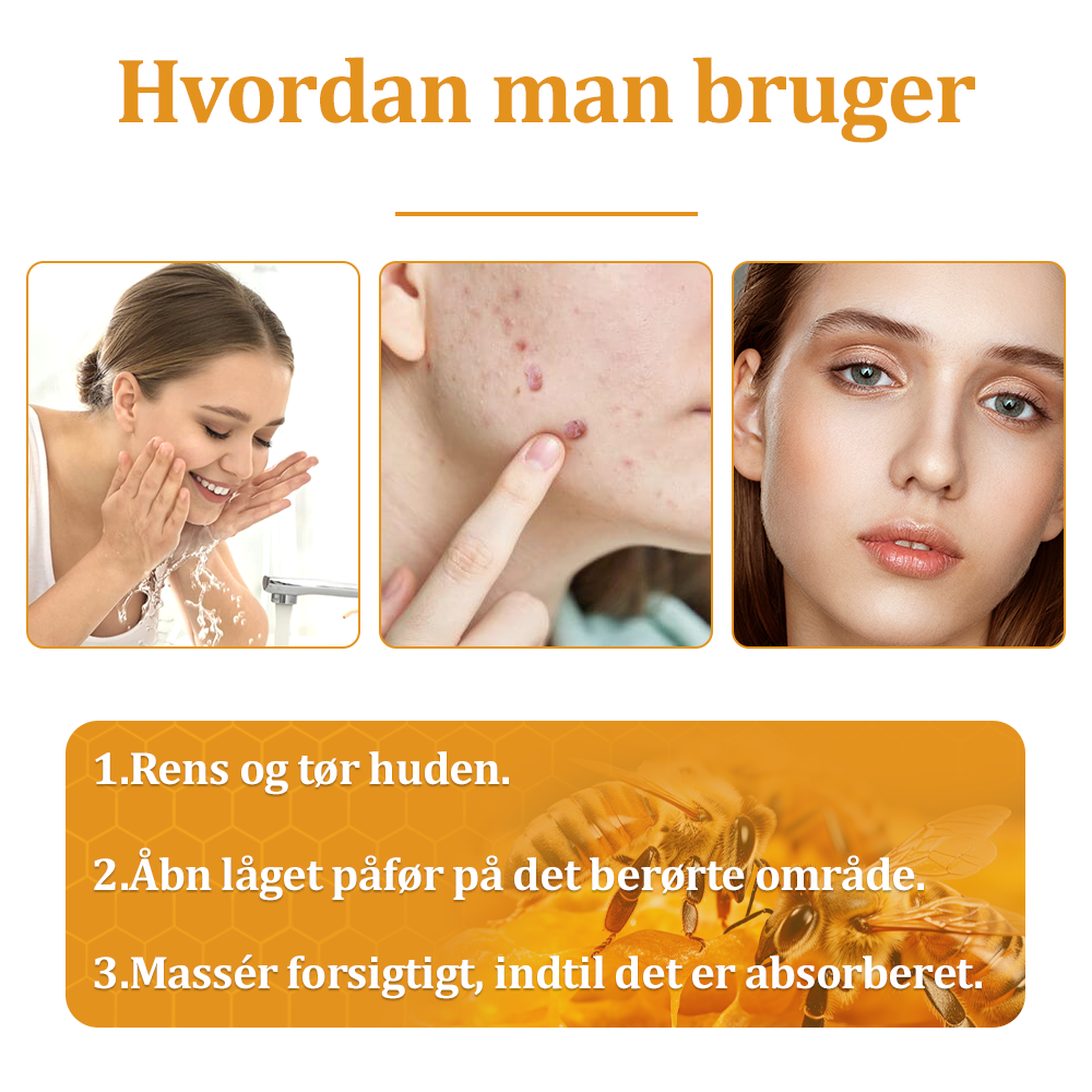 🎁flysmus™ Creme mod Hudflap & Vorter, Hjælper med at behandle vedvarende vorter, hudvækster, hudlæsioner, infektioner, ardannelse og udglatte ujævn hud❤️