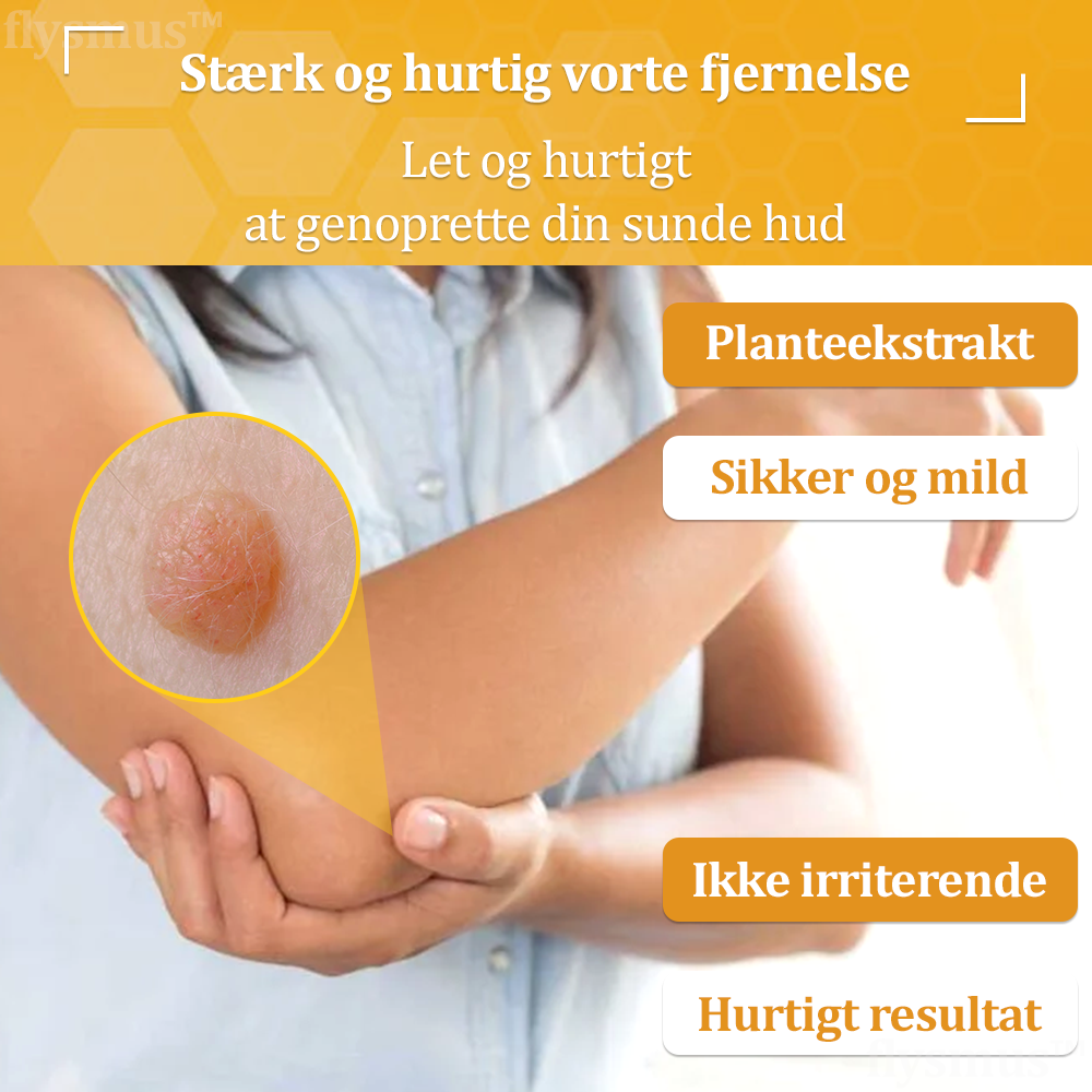 🎁flysmus™ Creme mod Hudflap & Vorter, Hjælper med at behandle vedvarende vorter, hudvækster, hudlæsioner, infektioner, ardannelse og udglatte ujævn hud❤️