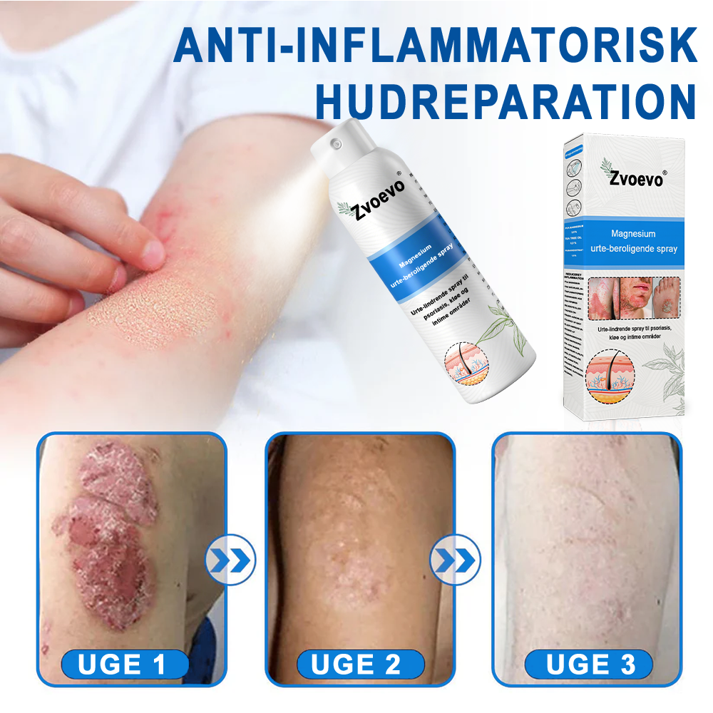 ✅ Officiel butik: Zvoevo® Magnesium Urte-psoriasis Spray(Lindrer psoriasis og eksem, forbedrer bakterielle infektioner i intimområdet, behandler akne og vorter, lindrer ledsmerter og nervesmerter)