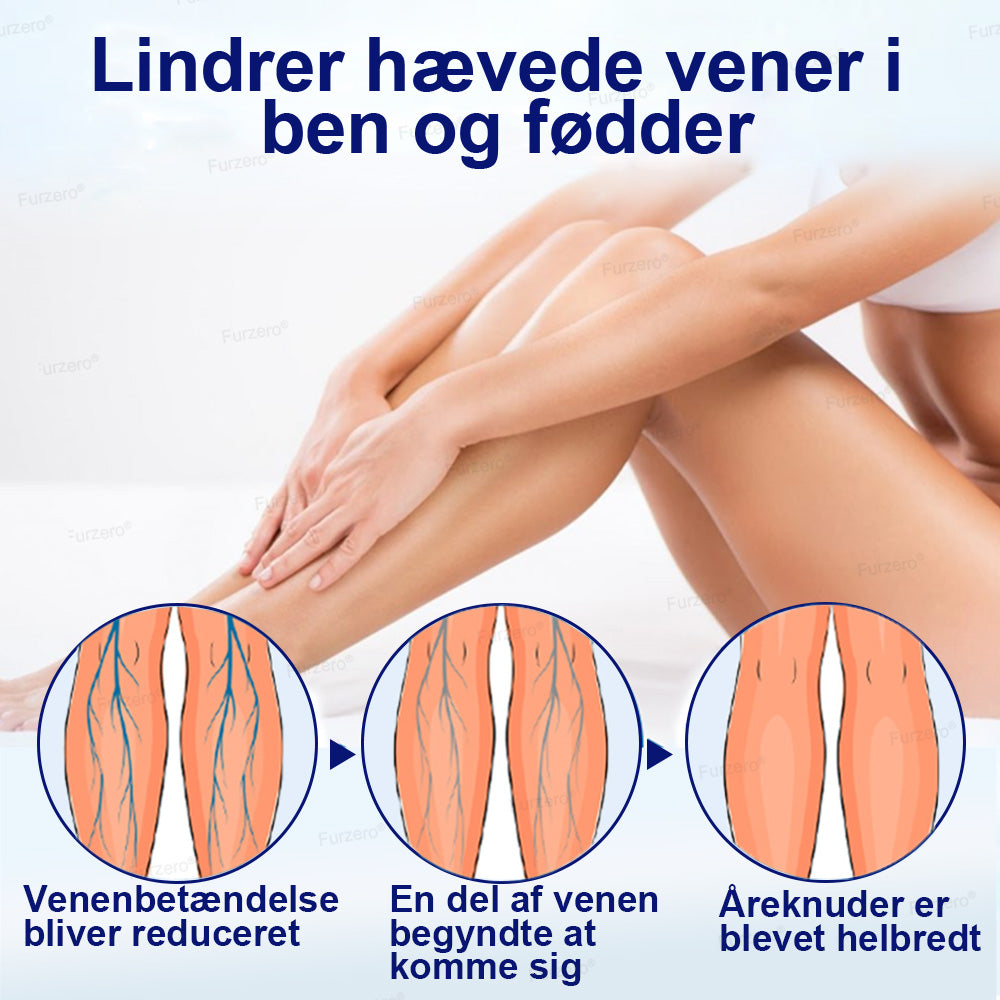 ✨Lavet og sendt fra Danmark🌿Furzero® VeinFreedom Urte-spray - Mikrotåge-terapi