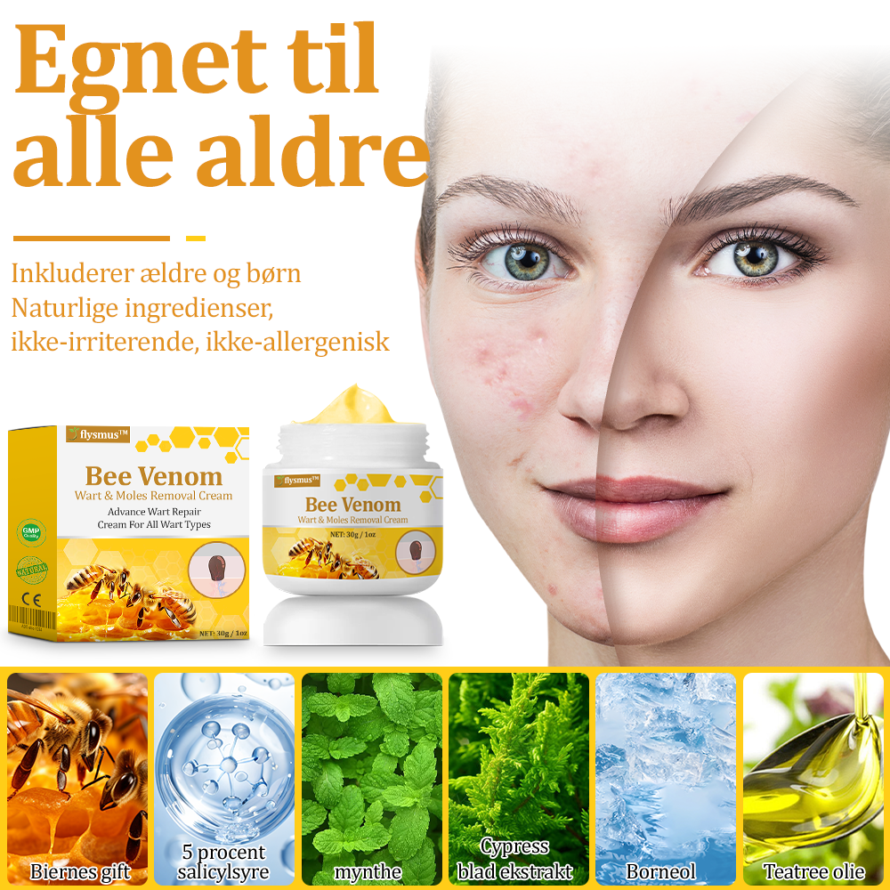 🎁flysmus™ Creme mod Hudflap & Vorter, Hjælper med at behandle vedvarende vorter, hudvækster, hudlæsioner, infektioner, ardannelse og udglatte ujævn hud❤️