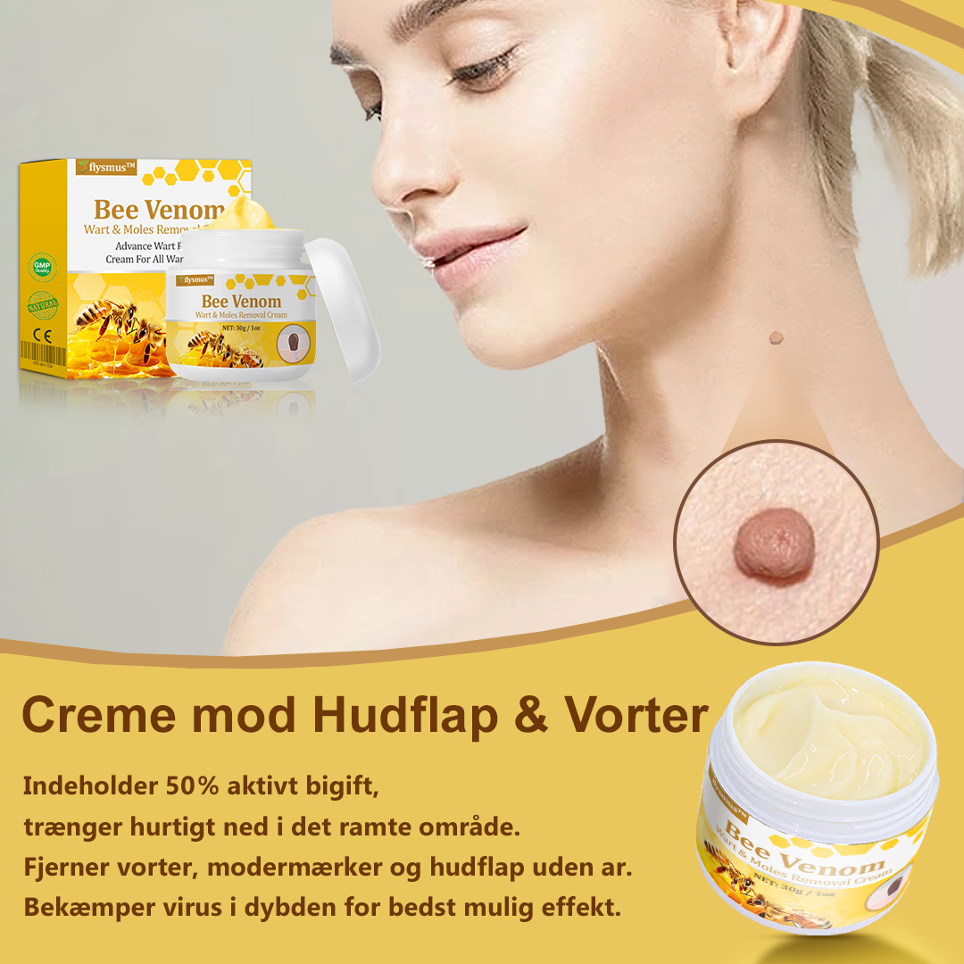 🐝flysmus™ Creme mod Hudflap & Vorter❤️Hjælper med at behandle vedvarende vorter, hudvækster, hudlæsioner, infektioner, ardannelse og udglatte ujævn hud