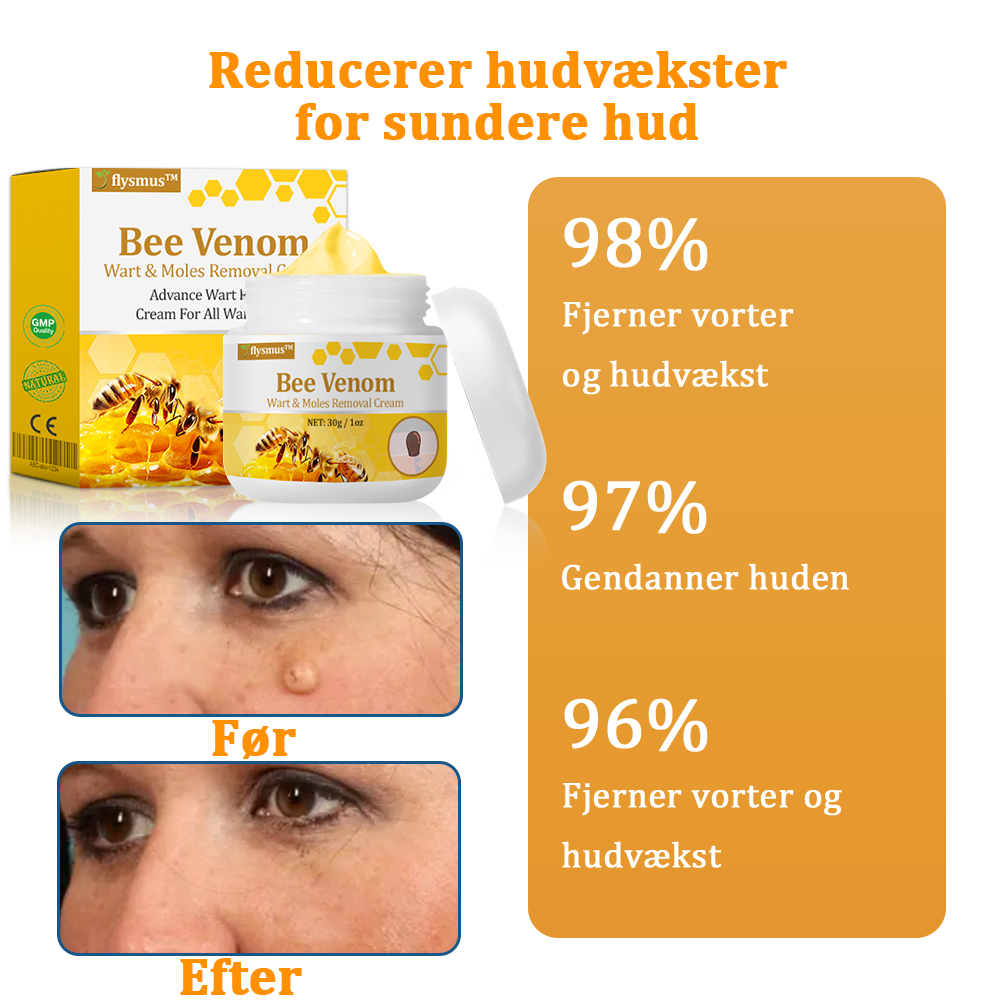 🎁flysmus™ Creme mod Hudflap & Vorter, Hjælper med at behandle vedvarende vorter, hudvækster, hudlæsioner, infektioner, ardannelse og udglatte ujævn hud❤️