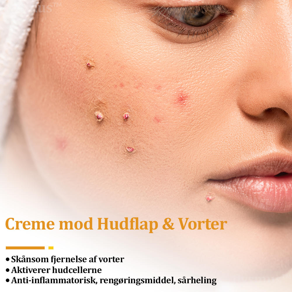 🎁flysmus™ Creme mod Hudflap & Vorter, Hjælper med at behandle vedvarende vorter, hudvækster, hudlæsioner, infektioner, ardannelse og udglatte ujævn hud❤️