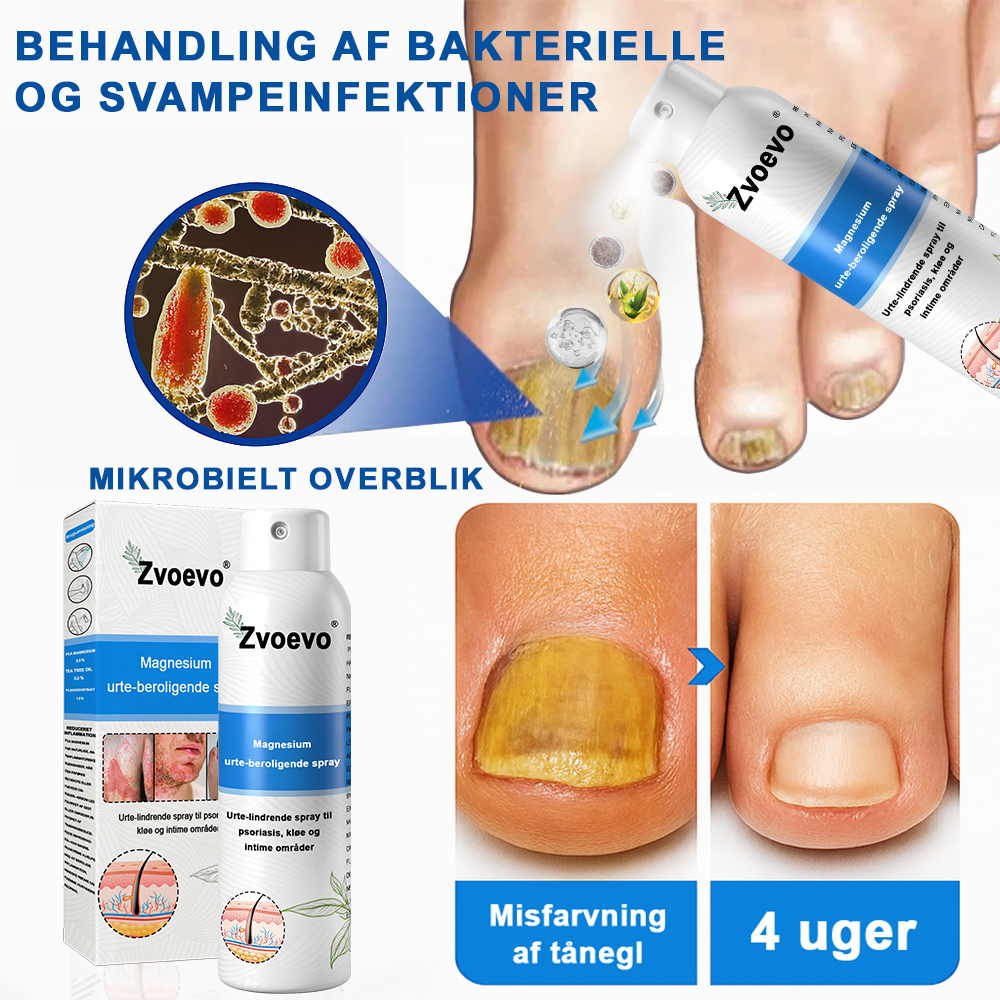 ✅ Officiel butik: Zvoevo® Magnesium Urte-psoriasis Spray(Lindrer psoriasis og eksem, forbedrer bakterielle infektioner i intimområdet, behandler akne og vorter, lindrer ledsmerter og nervesmerter)