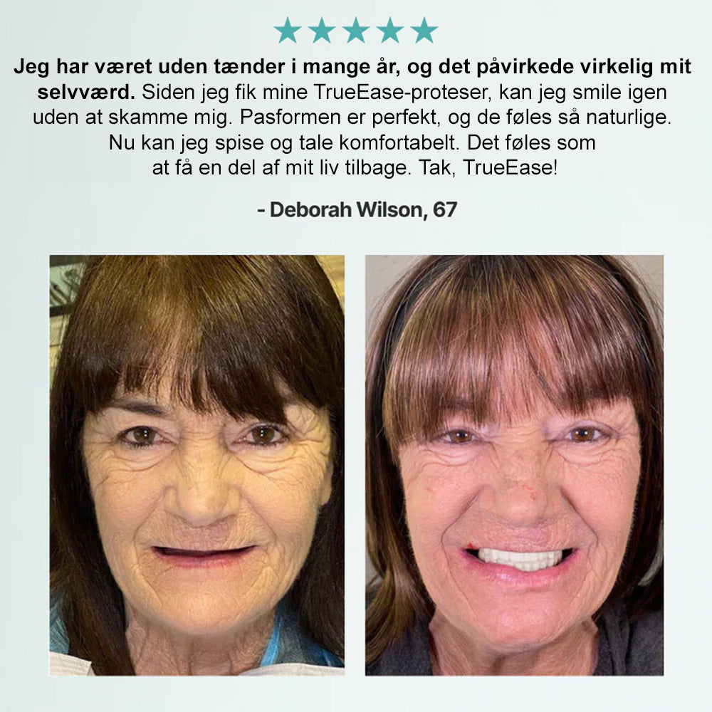 🦷Bikenda®🦷 Avanceret Tilpasset Fuldt Tandprotesesæt (✅ Klinisk dokumenterede komfort-pas tandproteser — Bruges og stole på af mere end 8.000 brugere i Danmark for komfort hele dagen.)