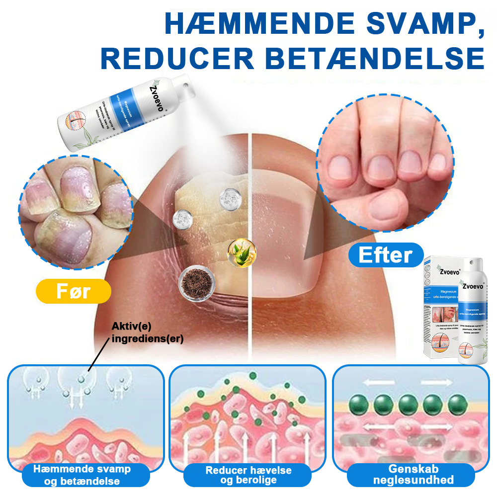 ✅ Officiel butik: Zvoevo® Magnesium Urte-psoriasis Spray(Lindrer psoriasis og eksem, forbedrer bakterielle infektioner i intimområdet, behandler akne og vorter, lindrer ledsmerter og nervesmerter)