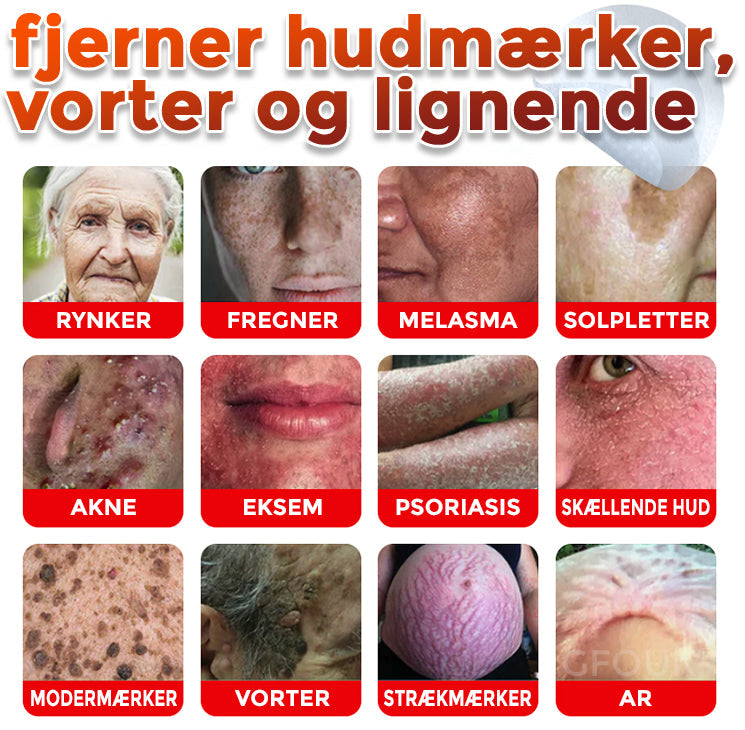 GFOUK® Botanisk Mikronålplaster til fjernelse af hudmærker (danish)
