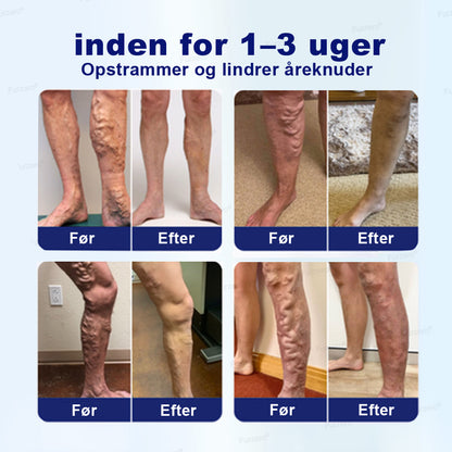 💙Lavet og sendt fra Danmark🌿Furzero® VeinFreedom Urte-spray - Mikrotåge-terapi