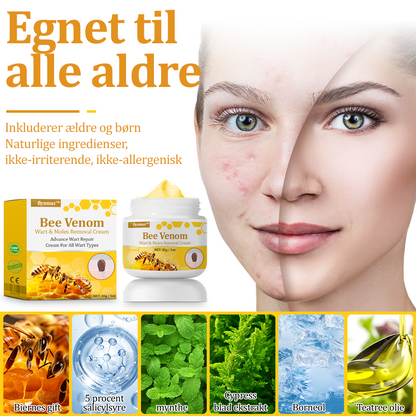 🧑‍⚕️flysmus™ Creme mod Hudflap & Vorter, Hjælper med at behandle vedvarende vorter, hudvækster, hudlæsioner, infektioner, ardannelse og udglatte ujævn hud✨