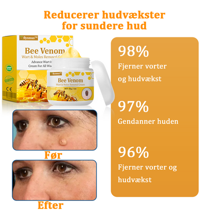 🧑‍⚕️flysmus™ Creme mod Hudflap & Vorter, Hjælper med at behandle vedvarende vorter, hudvækster, hudlæsioner, infektioner, ardannelse og udglatte ujævn hud✨