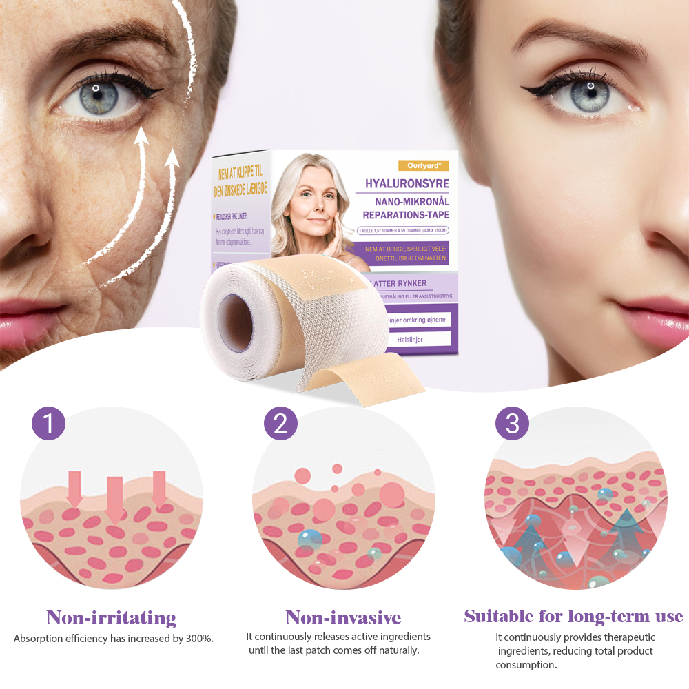 ✅ Officiel butik | Ourlyard® Hyaluronsyre Nano Microneedle Repareringsbånd 🧑‍⚕️☑️(Reparerer rynker, fine linjer, løs hud osv., egnet til flere områder som ansigt, hænder, mave, ben – 4 cm x 1,5 m rulle. Klinisk testet og dermatologisk anbefalet)