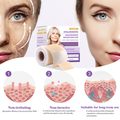 ✅ Officiel butik | Ourlyard® Hyaluronsyre Nano Microneedle Repareringsbånd 🧑‍⚕️☑️(Reparerer rynker, fine linjer, løs hud osv., egnet til flere områder som ansigt, hænder, mave, ben – 4 cm x 1,5 m rulle. Klinisk testet og dermatologisk anbefalet)