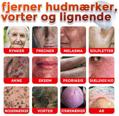 GFOUK® Botanisk Mikronålplaster til fjernelse af hudmærker