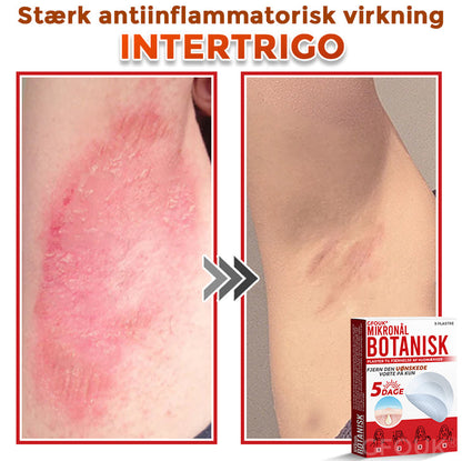 GFOUK® Botanisk Mikronålplaster til fjernelse af hudmærker